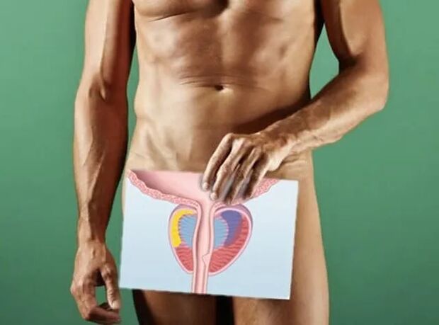 Prostatitis bei Männern