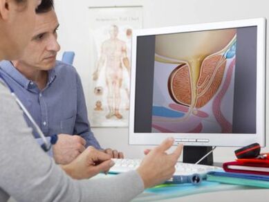 Ein Urologe berät einen Patienten zu Prostatitis und Behandlungsmethoden.